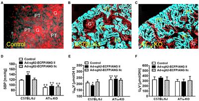 Intratubular, Intracellular, and Mitochondrial Angiotensin II/AT1 (AT1a) Receptor/NHE3 Signaling Plays a Critical Role in Angiotensin II-Induced Hypertension and Kidney Injury